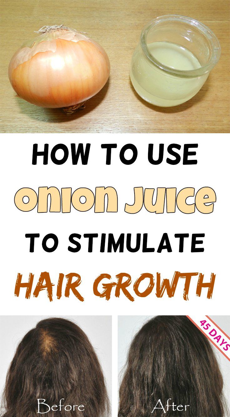 How To Speed Up The Hair Grow With Onion Juice