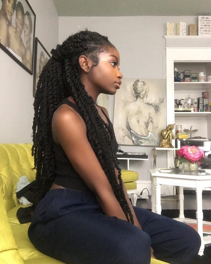 Why Our Hair Started Getting so Dandruff?