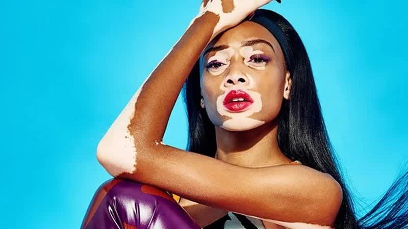 Winnie Harlow