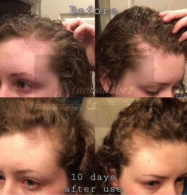 rice water effect on hair BuMf01RH1Sb